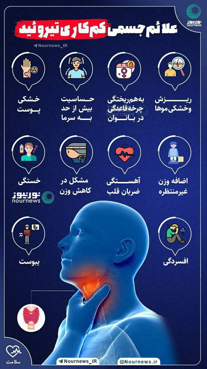 علائم جسمی کم کاری تیروئید