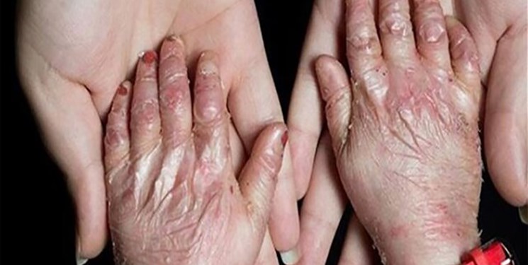 خبری امیدوارکننده برای بیماران خاص و صعب‌العلاجی/ 107 بیماری تحت پوشش صندوق بیماری‌های خاص قرار گرفت