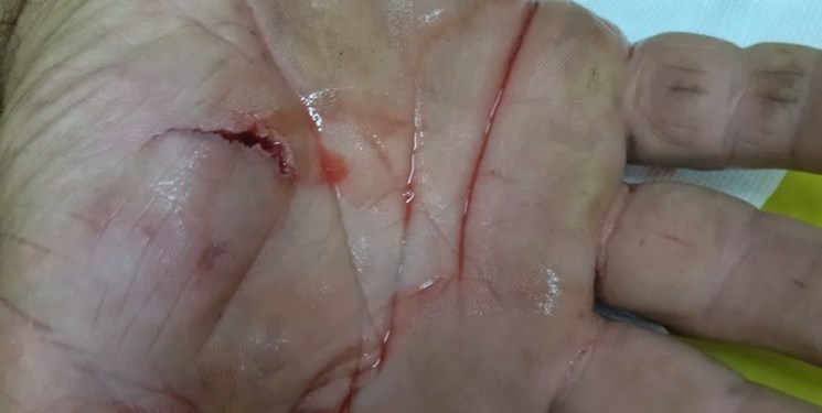 ماجرای حمله خرس وحشی به پیرمرد ماسالی + عکس