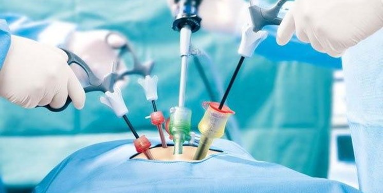 انجام نخستین عمل جراحی به روش لاپاراسکوپی در مرکز ناباروری بهشهر