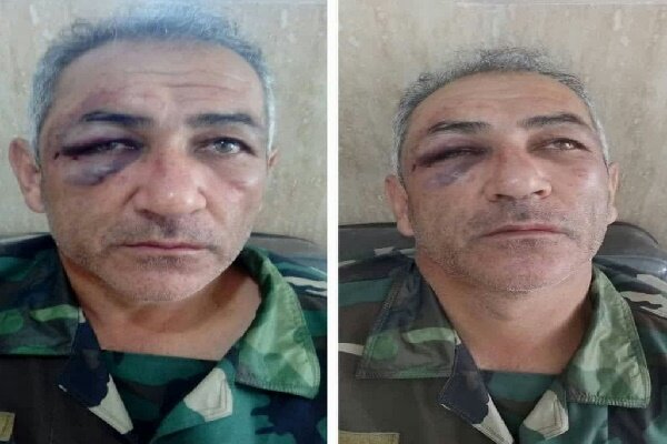 ضرب و شتم یک جنگلبان توسط قاچاقچیان در آستارا