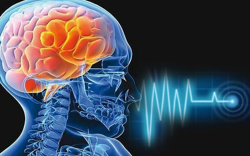 سکته مغزی ایسکمیک چیست؟ /راهکارهای پیشگیری از سکته مغزی