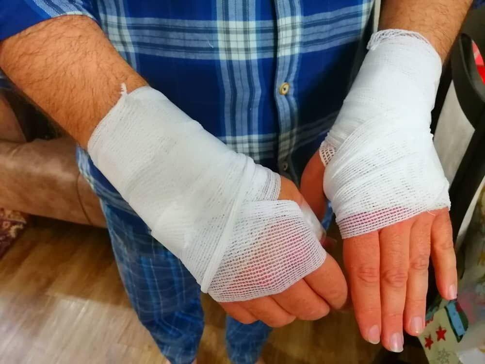 73 گلستانی در حوادث چهارشنبه سوری مصدوم شدند