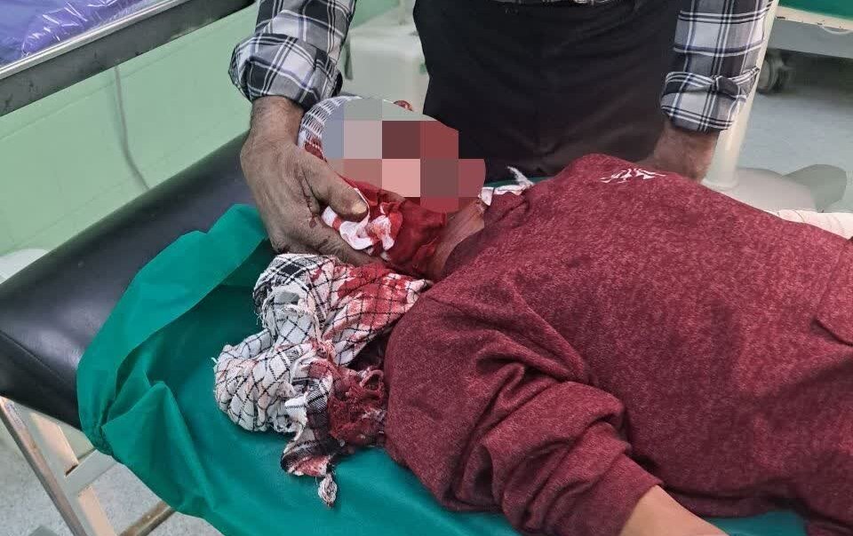 مصدومیت 18 نفر در مراسم چهارشنبه آخر سال گیلان