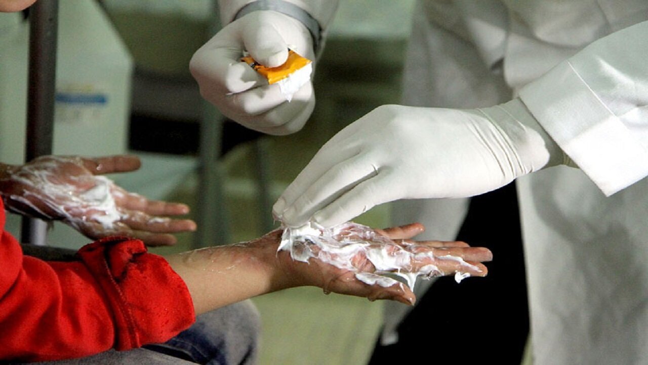 22 گلستانی در چهارشنبه سوری زخمی شدند